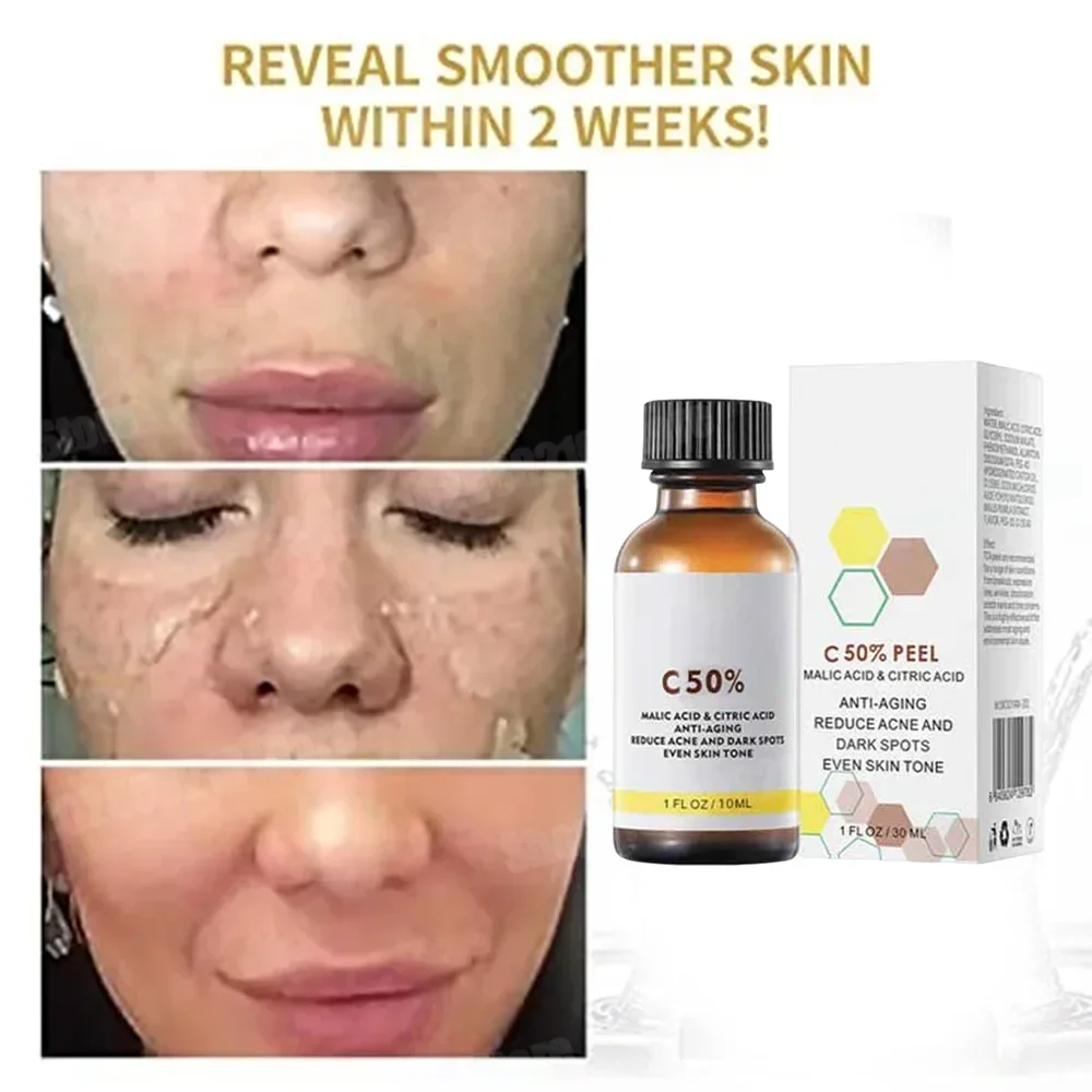 Tranexamic Acid Serum - Salicylic Acid Face Facial Peel Neutraliser