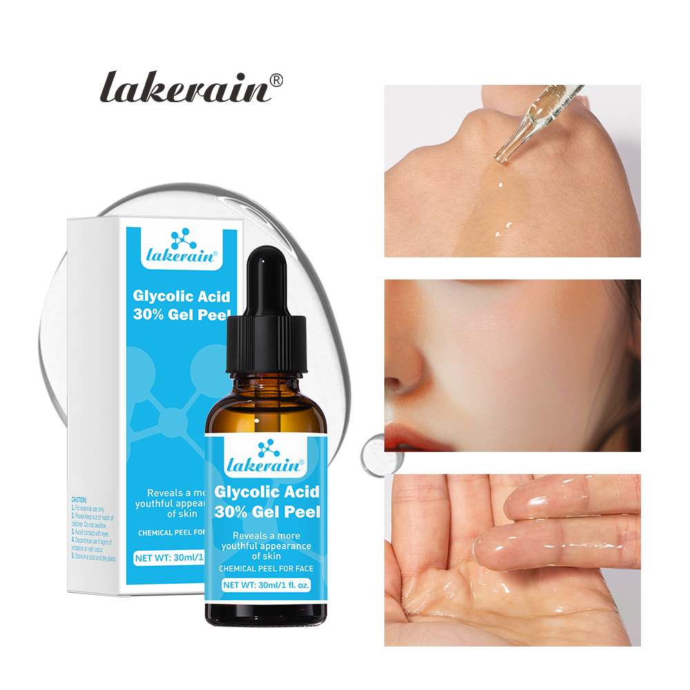 Glycolic Acid Exfoliant - เจลลอกผิวด้วยกรดไกลโคลิก30% สารเคมีเกรดมืออาชีพสำหรับการเกิดสิวช่วยเพิ่มคอลลาเจนริ้วรอยและริ้วรอย