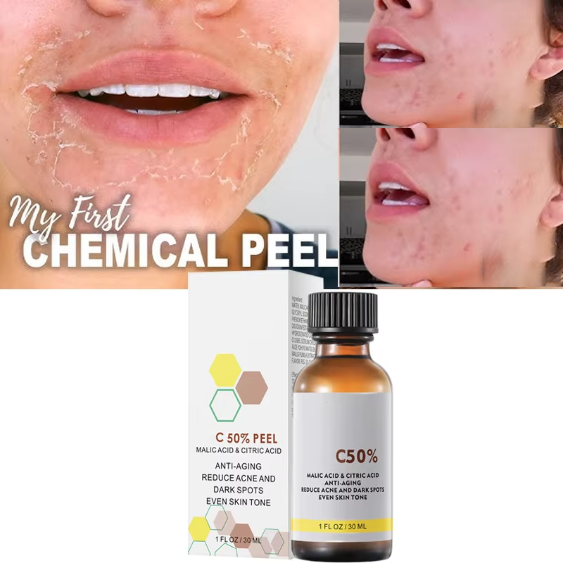 Tranexamic Acid Serum - ด้วย Malic Acid และกรดซิตริกสําหรับ Face Facial