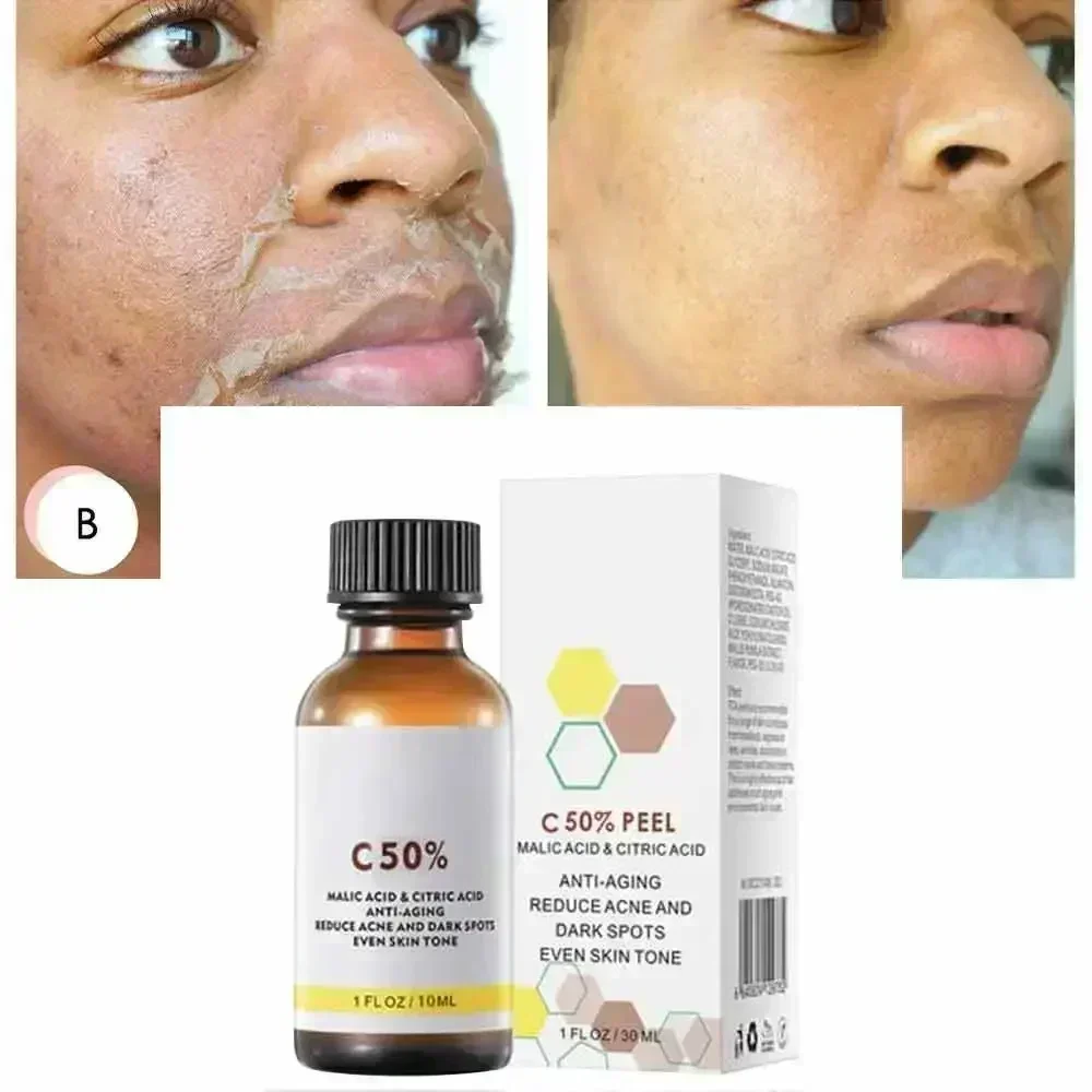 Salicylic Acid Face Facial Pee - Tranexamic Acid Serum บทวิจารณ์และราคา
