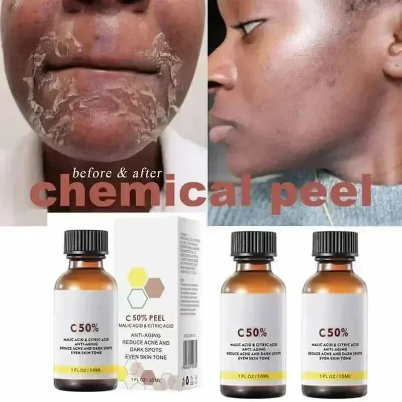 Salicylic Acid Face Facial Pee - Tranexamic Acid Serum บทวิจารณ์และราคา
