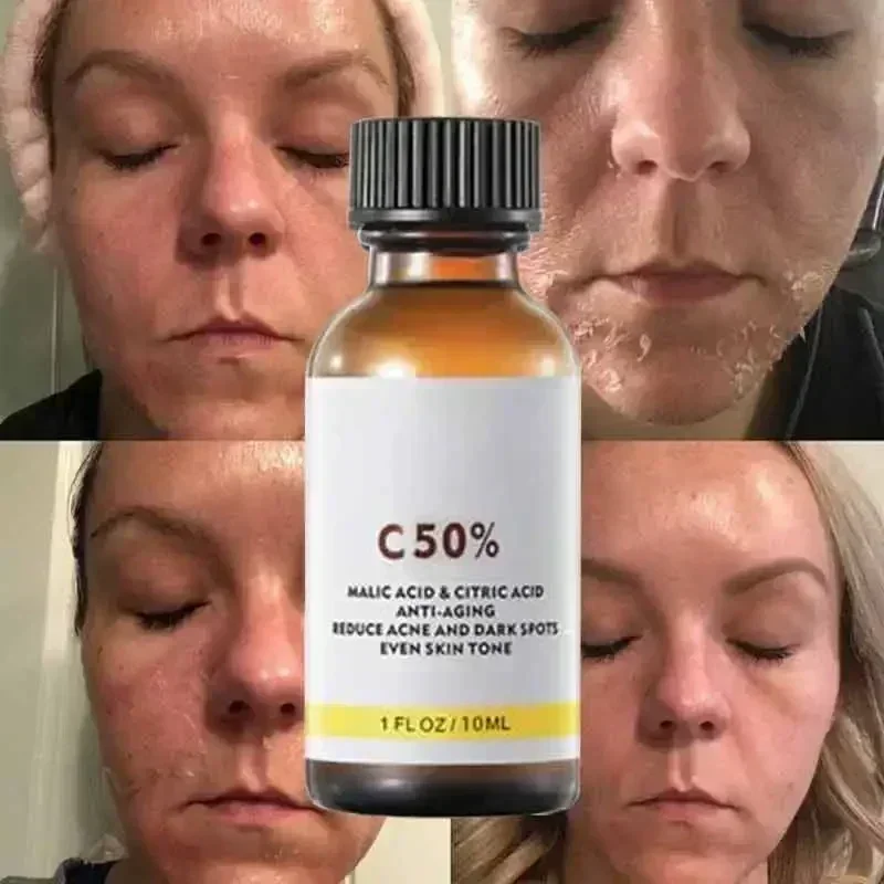 Salicylic Acid Face Facial Pee - Tranexamic Acid Serum บทวิจารณ์และราคา