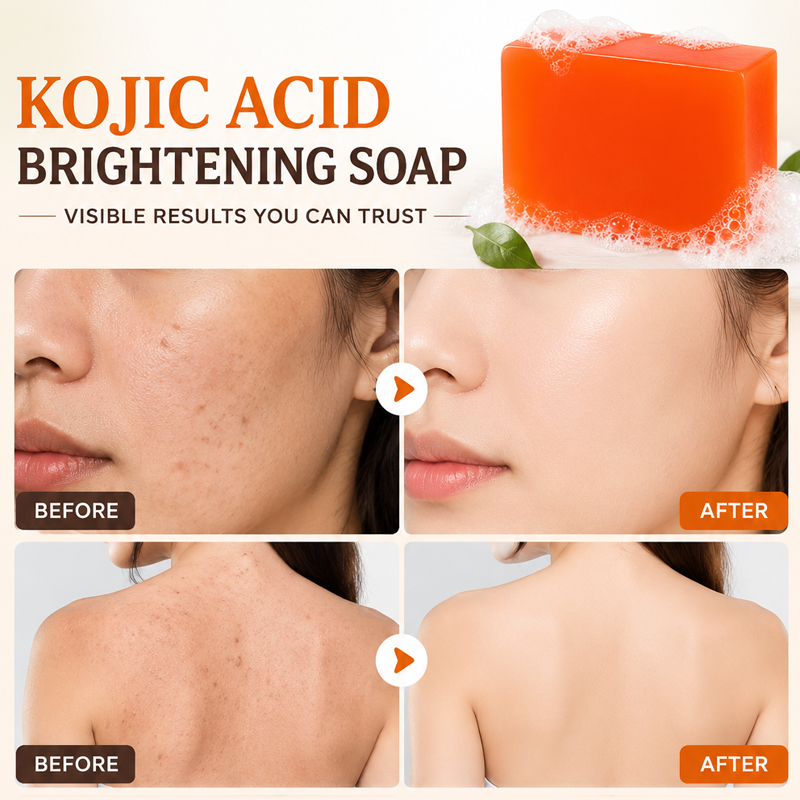 สบู่โคจิกแอซิด 6 ก้อน ช่วยปรับ - Glycolic Acid Exfoliant บทวิจารณ์และราคา