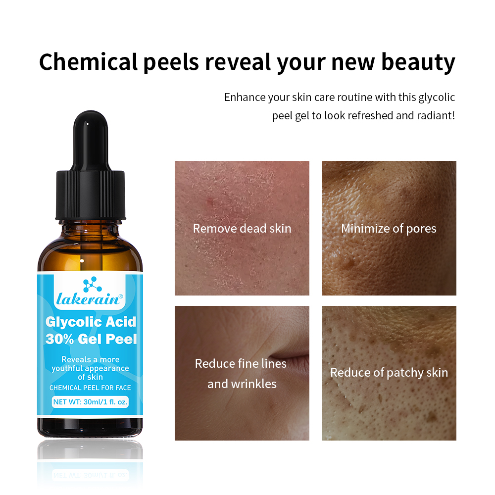 เจลลอกผิวด้วยกรดไกลโคลิก30% สา - Glycolic Acid Exfoliant บทวิจารณ์และราคา