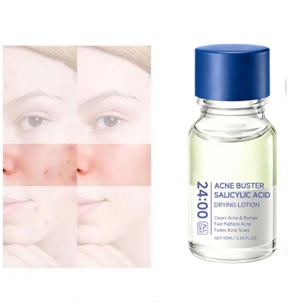 ซาลิไซลิก แอซิด เอสเซ้นส์ ทรีท - Tranexamic Acid Serum บทวิจารณ์และราคา