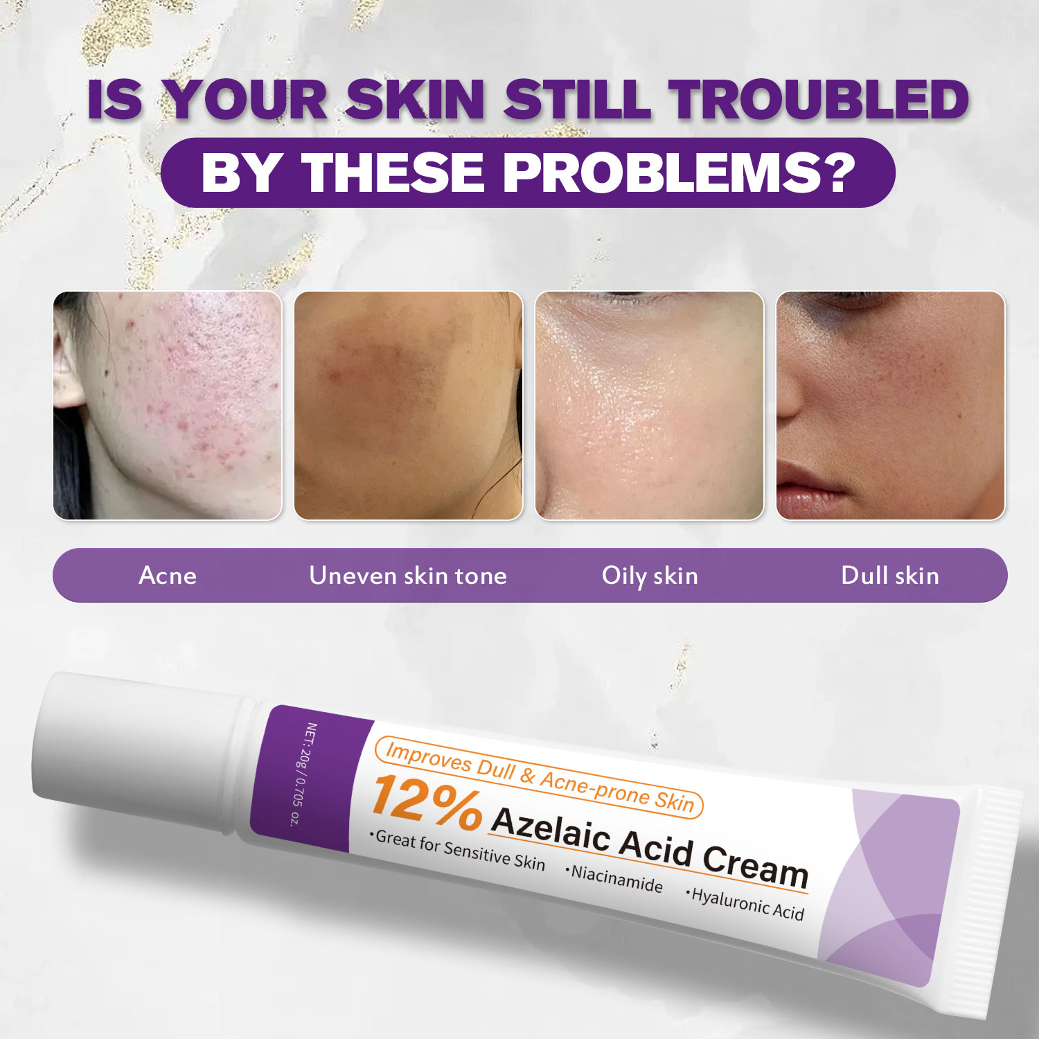 ครีมกรดอะซีเลอิกสูตรอ่อนโยน ช่ - Azelaic Acid Serum บทวิจารณ์และราคา