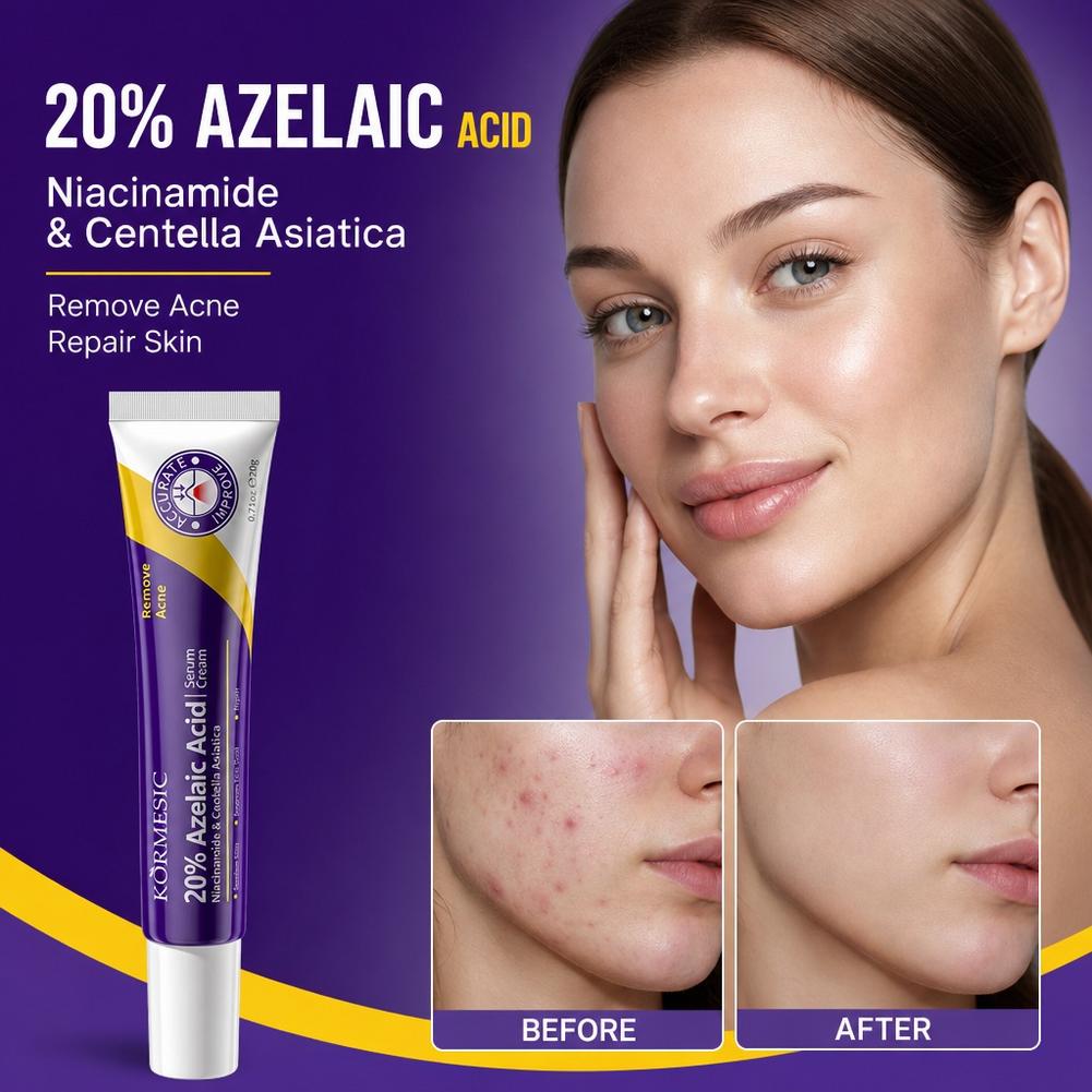 เอสเซนส์กรดอะซีเลอิก 20% ครีมบ - Azelaic Acid Serum บทวิจารณ์และราคา