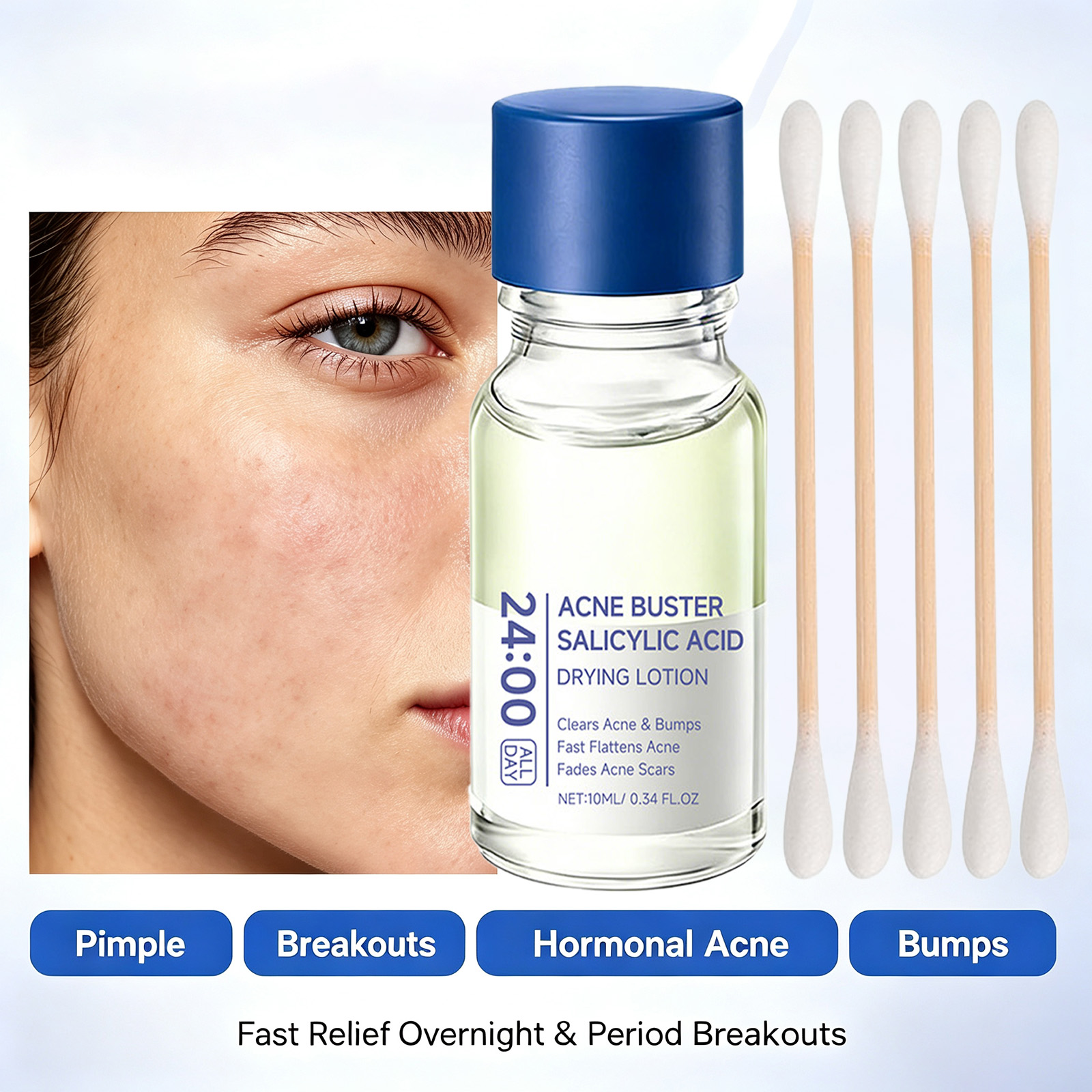 เซรั่มรักษาสิวกรดซาลิไซลิก ลดร - Tranexamic Acid Serum บทวิจารณ์และราคา