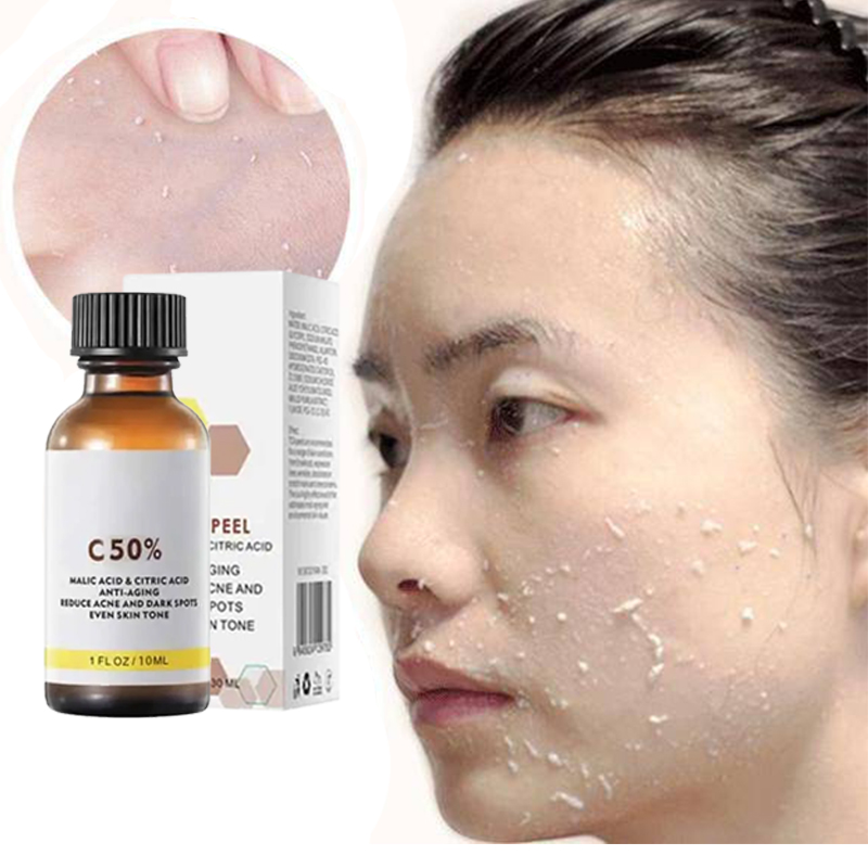น้ำมันผลัดเซลล์ผิวที่ 3 สำหรับ - Azelaic Acid Serum บทวิจารณ์และราคา