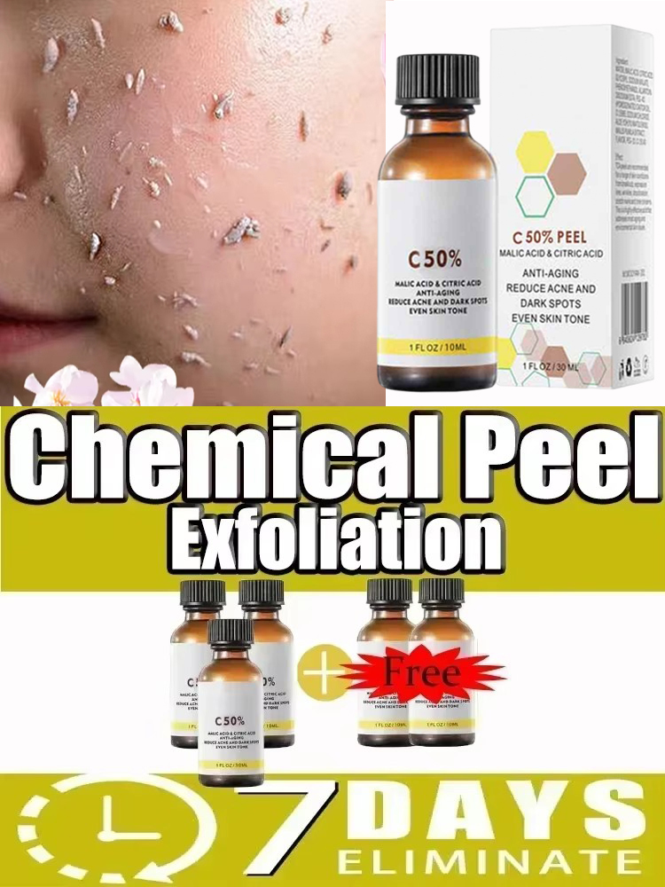 น้ำมันผลัดเซลล์ผิวที่ 3 สำหรับ - Azelaic Acid Serum บทวิจารณ์และราคา